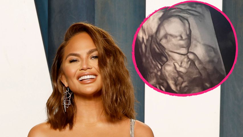 Süß: Schwangere Chrissy Teigen postet erstes Ultraschallbild