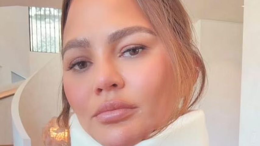 Unfall: Chrissy Teigen teilt Fotos mit einer Halskrause!
