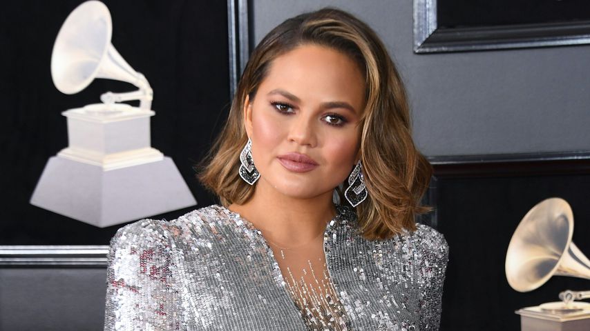 Cremes haben versagt: Chrissy Teigen zeigt Dehnungs-Streifen