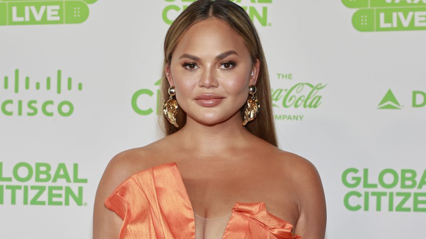 Ein Jahr nach Brust-OP: Chrissy Teigen zeigt ihre Narben