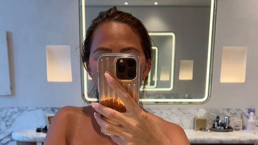 Oben-ohne-Foto: Chrissy Teigen zeigt ihre Bräunungsstreifen