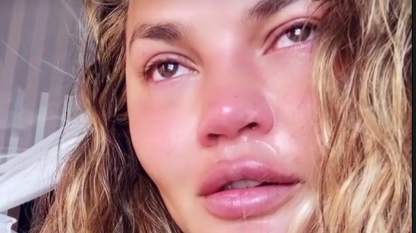 Chrissy Teigen zeigt sich weinend nach einer Therapiestunde