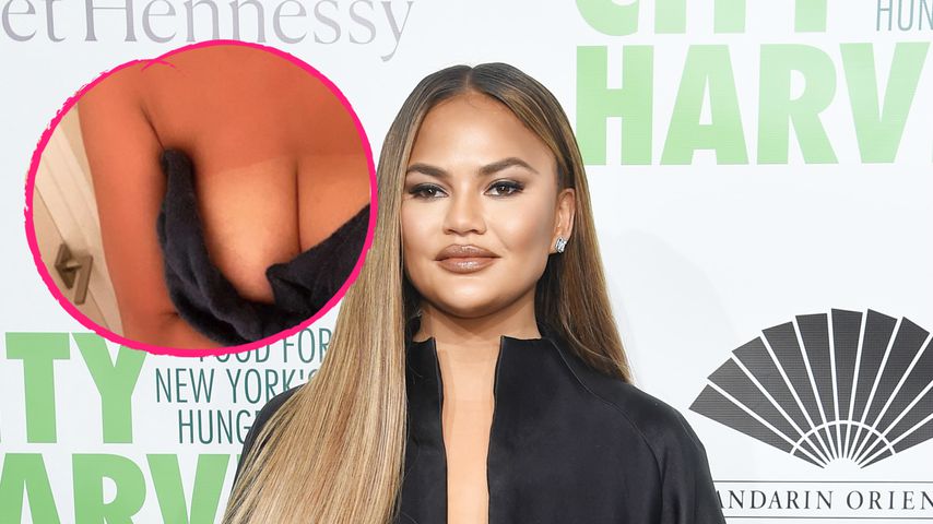 Weiße Brüste: Chrissy Teigen zeigt ihren Bräunungs-Fail