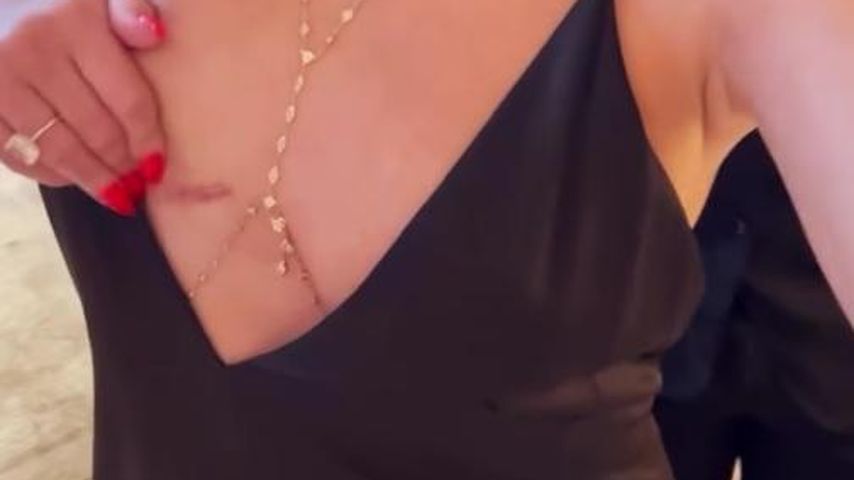 Chrissy Teigen im August 2024