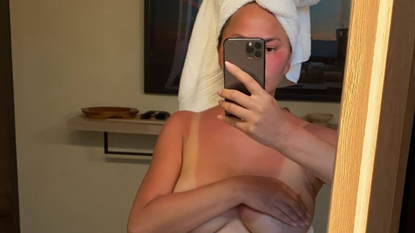 Nach Brust-OP: Chrissy Teigen zeigt sich (fast) oben ohne!