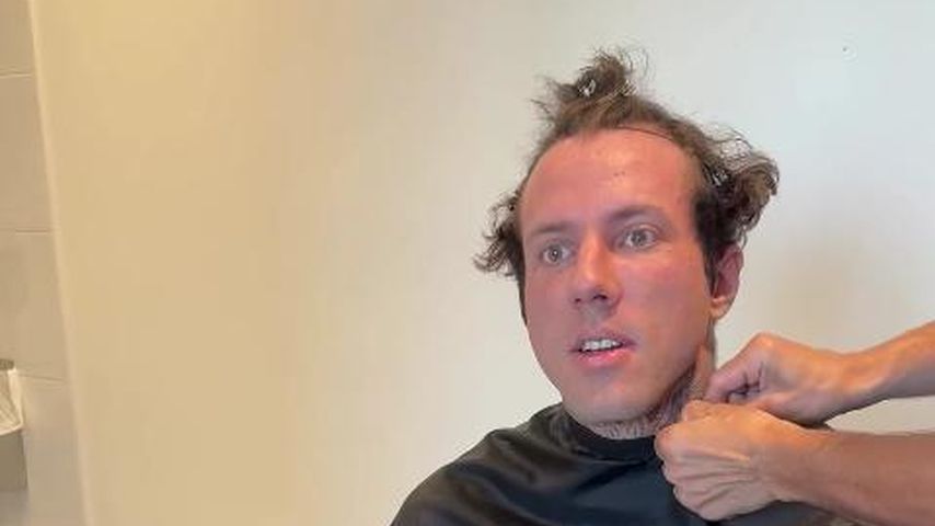 Wegen Stress: Christian Wolf brauchte Haartransplantation!
