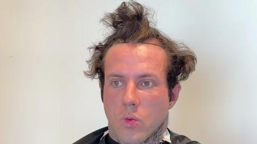 "Krusty der Clown": Fans lachen über Christian Wolfs Haare