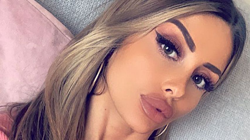 Beauty-Wahn? Das hat Christina Dimitriou alles machen lassen
