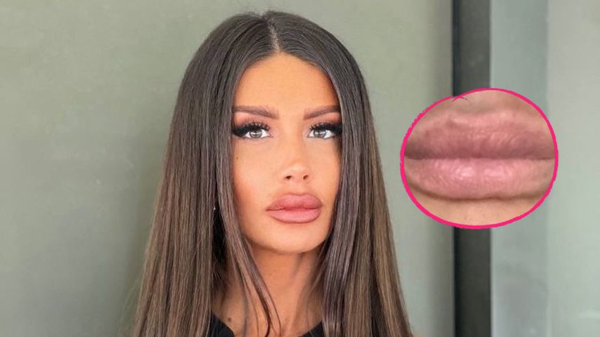 Natürlich: Christina Dimitriou zeigt ihre Lippen ohne Filler