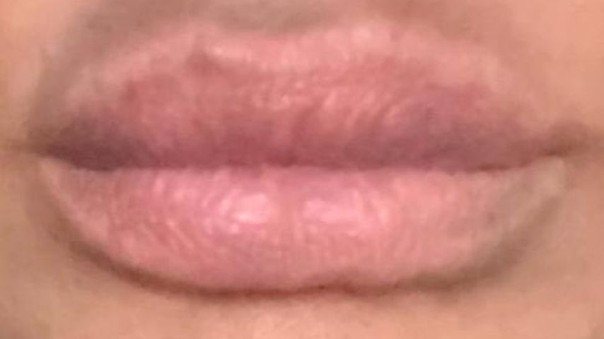 Christina Dimitrious natürliche Lippen