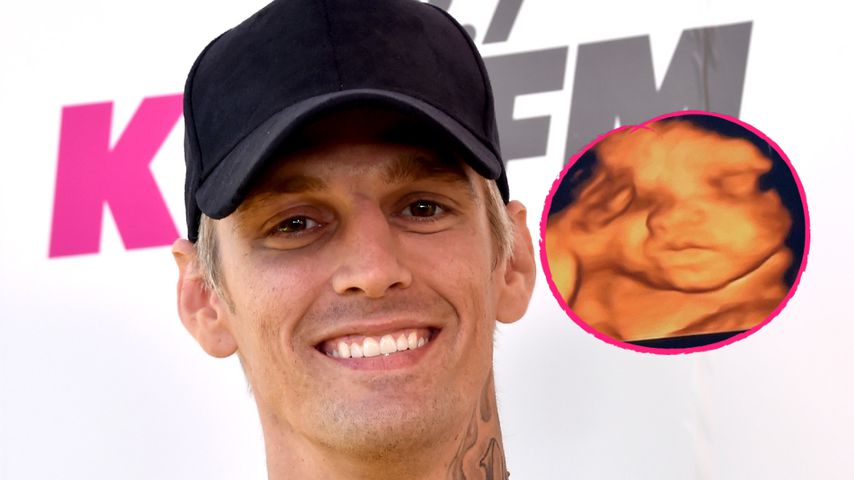 "Mein Engel": Aaron Carter teilt Ultraschallbild von Sohn