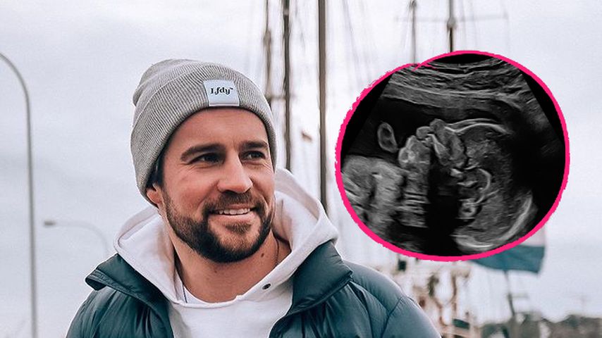 Ultraschallfoto: Bald-Papa Alex Hindersmann ist überwältigt!