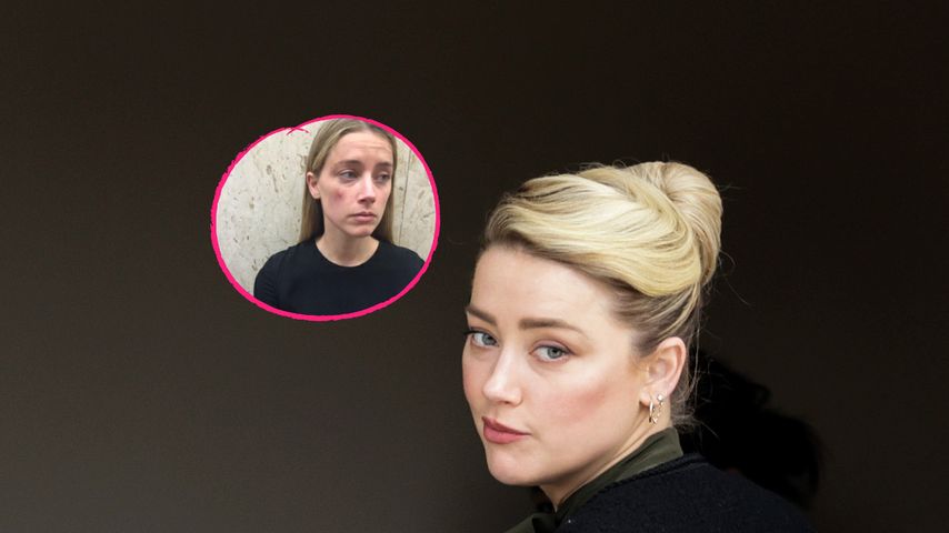 Experte sicher: Amber Heard hat Prügel-Bilder bearbeitet