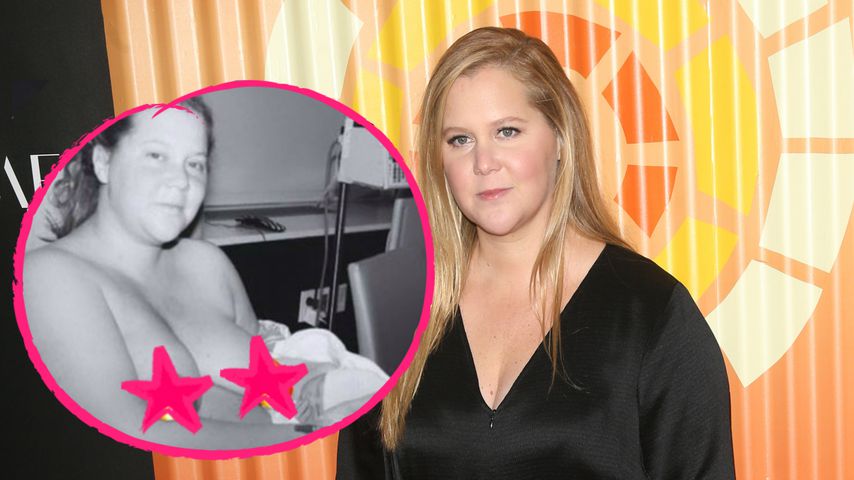 Offen: Amy Schumer teilt ein neues Bild kurz nach der Geburt