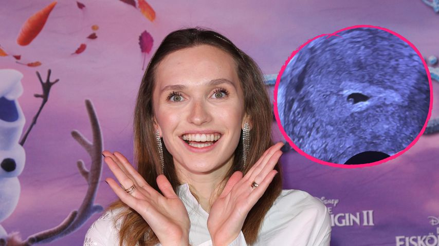 Erstes Ultraschallbild: Schwangere Anna Wilken extrem stolz