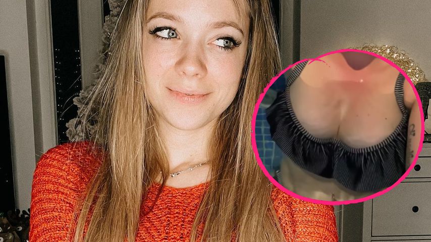 "Silberfischchen": Anne Wünsche zeigt Brust-Dehnungsstreifen