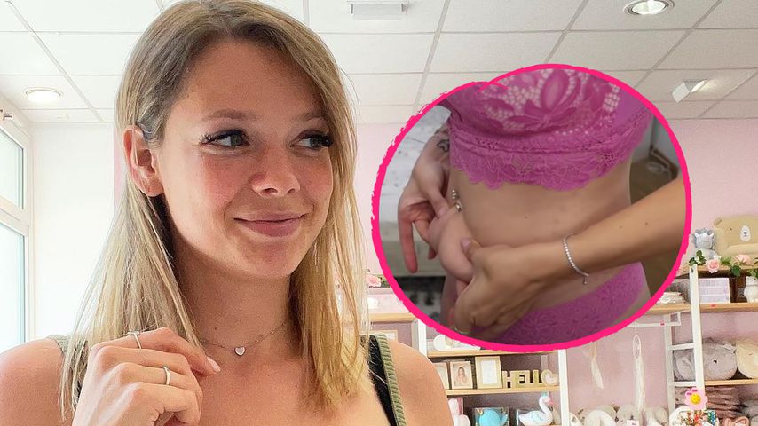 Dehnungsstreifen und Co.: Anne Wünsche zeigt ihre Makel