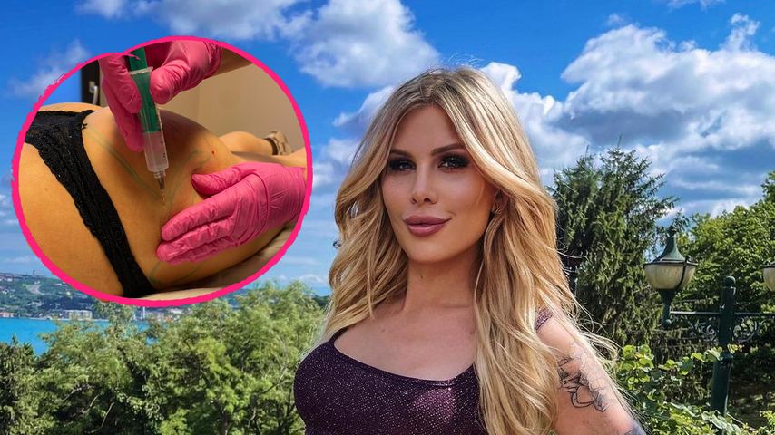 Nach BBL: Arielle Rippegather hatte zweite Po-Vergrößerung