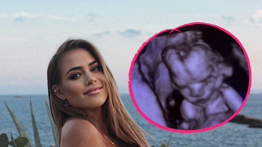 "Größtes Geschenk": Jessica Paszka teilt Ultraschallbilder