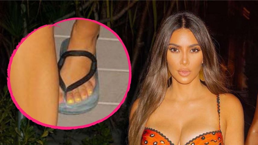 Schon wieder! Hat Kim Kardashian tatsächlich sechs Zehen?