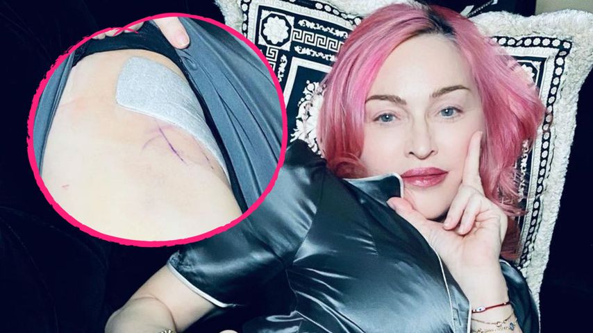 Mit Narbenfoto: Madonna bezeichnet sich als "Überlebende"