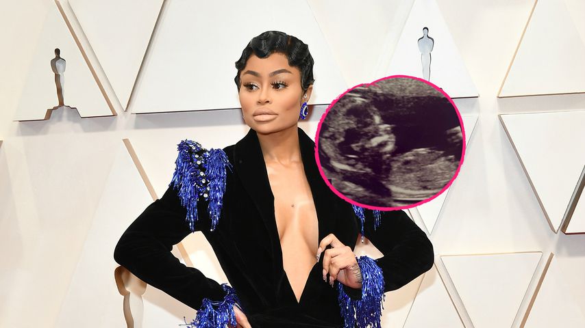Schwanger? Blac Chyna postet verdächtiges Ultraschall-Foto!