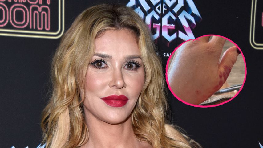 Mysteriöse Infektion: Brandi Glanville droht Amputation!