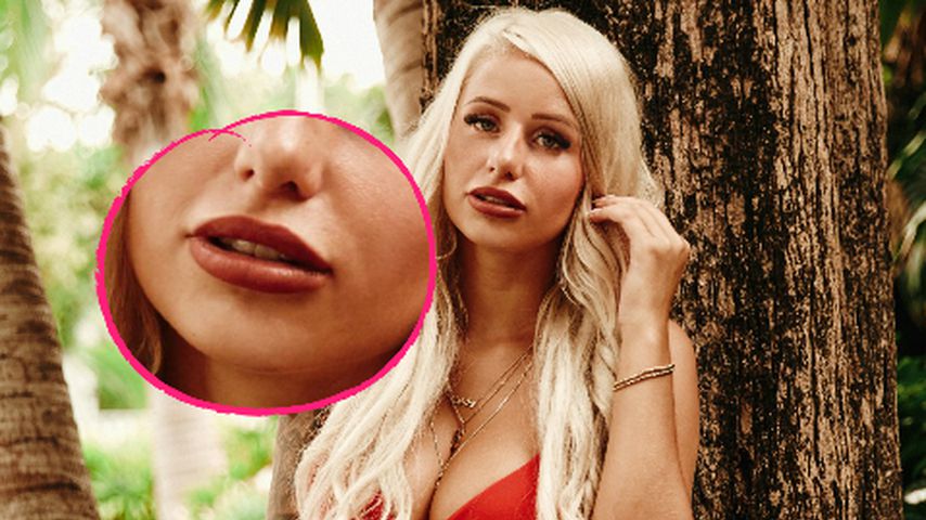 Entenschnabel: Lippen-Spritz-Fail bei Bachelor-Babe Carina?