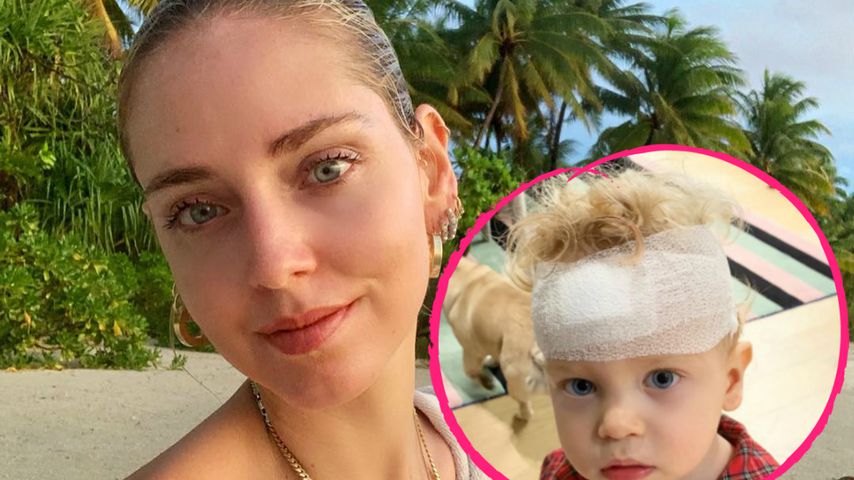 Chiara Ferragni in Sorge: Sohn Leone ist schlimm gestürzt