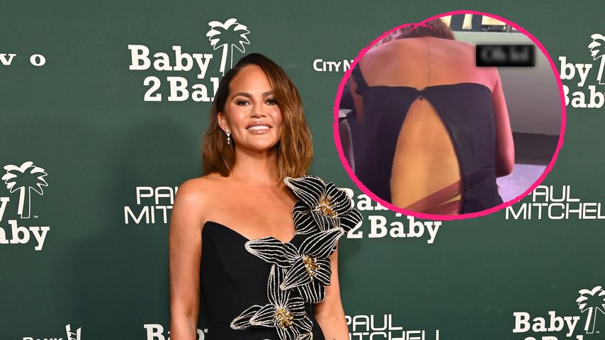 Fashion-Panne: Chrissy Teigens Kleid reißt bei Gala auf!