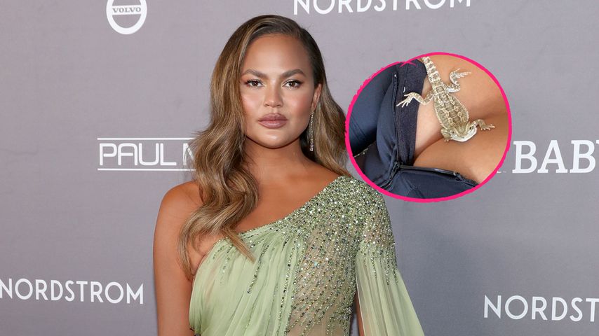 Implantate raus: Chrissy Teigen gibt jetzt ein Brust-Update