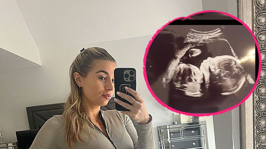 Dani Dyer teilt ein Ultraschallbild von eineiigen Zwillingen