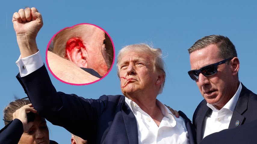 Nach Schießerei: Donald Trump muss nicht operiert werden!