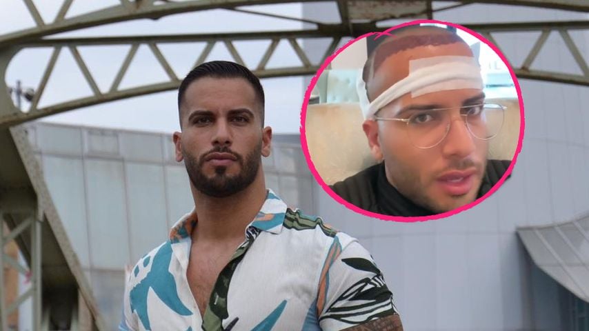 "Are You The One?"-Star Ferhat hatte Haartransplantation