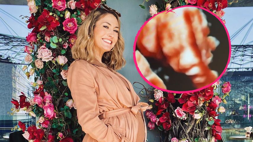 Wow: Fiona Erdmann zeigt 3D-Bild ihres ungeborenen Babys