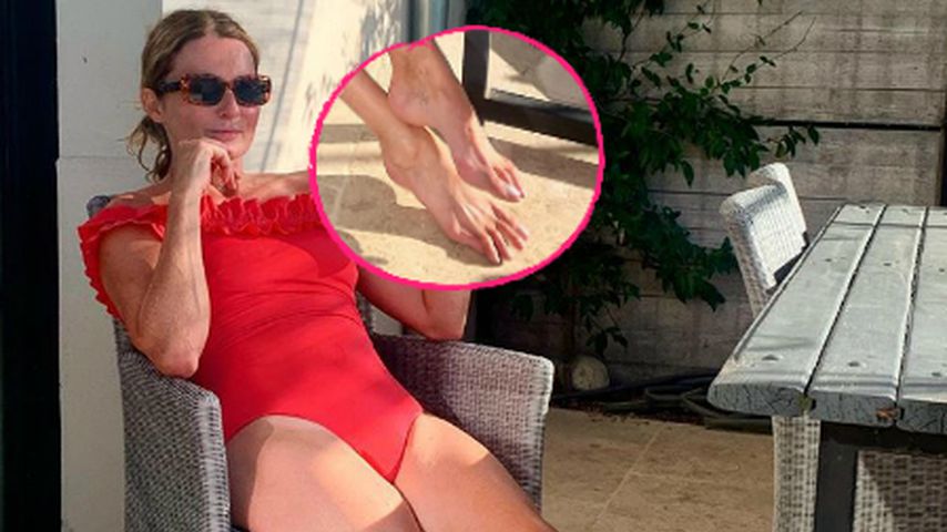 Photoshop-Füße? Frauke Ludowig sorgt mit Zehen für Aufsehen
