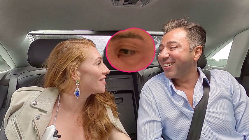 Mega zerkratzt! Hatten Kubi und Georgina gewaltsamen Streit?