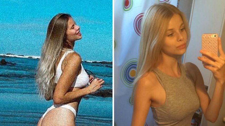 Histamin-Intoleranz: GNTM-Larissa zeigt Body-Transformation
