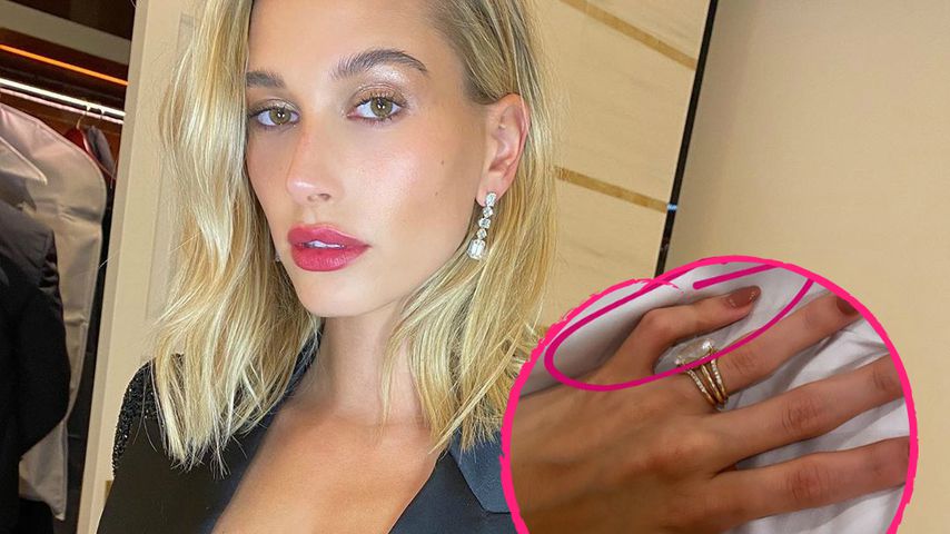 Gekrümmter Finger: Hailey Bieber hat eine genetische Störung