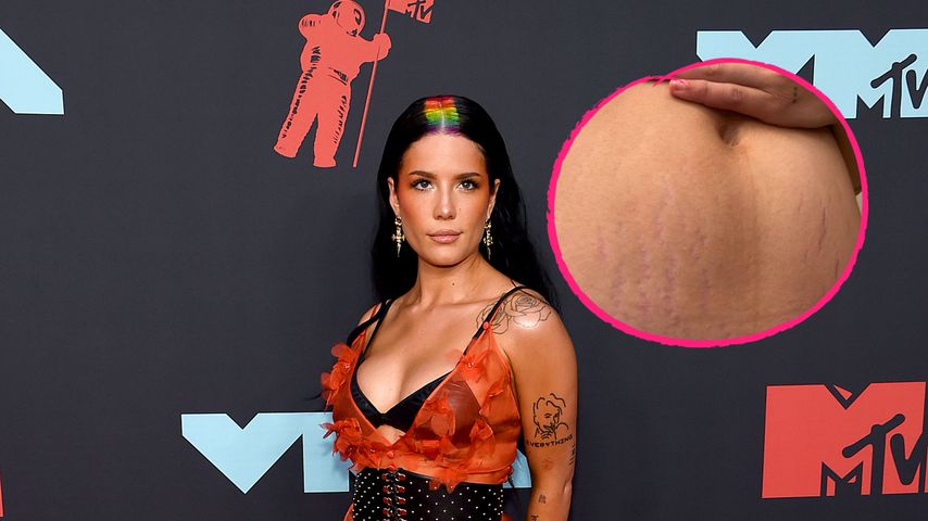 Ehrliches Pic: Neu-Mama Halsey zeigt ihre Dehnungsstreifen