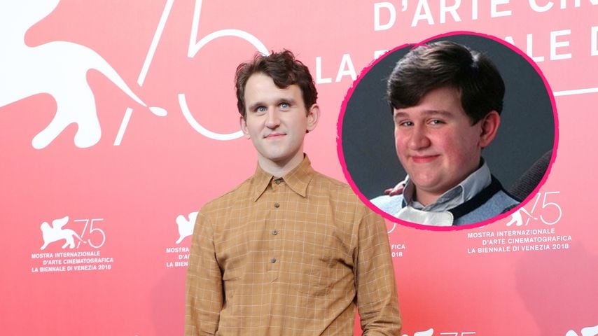 Gewusst? Erschlankter "Harry Potter"-Dudley trug Fatsuit