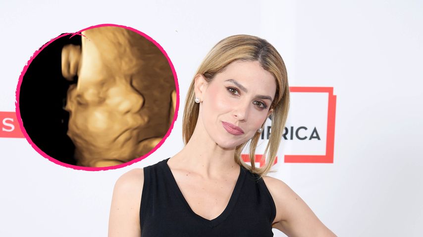 Hilaria Baldwin freut sich über neues Baby-Ultraschallbild!