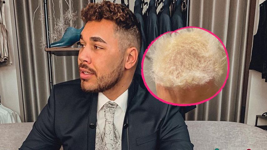 Mit Blondierung im Lift gefangen: BTN-Star fallen Haare aus