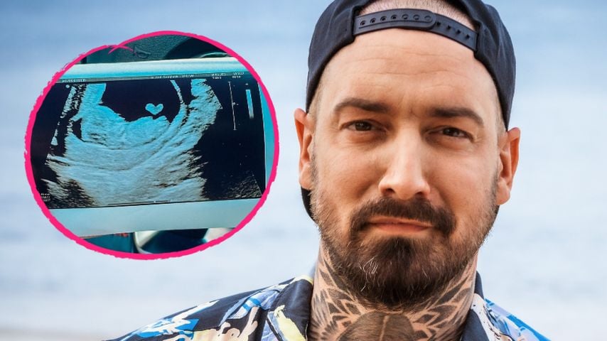 "Kleines Wunder": Jan Leyk teilt neues süßes Ultraschallbild