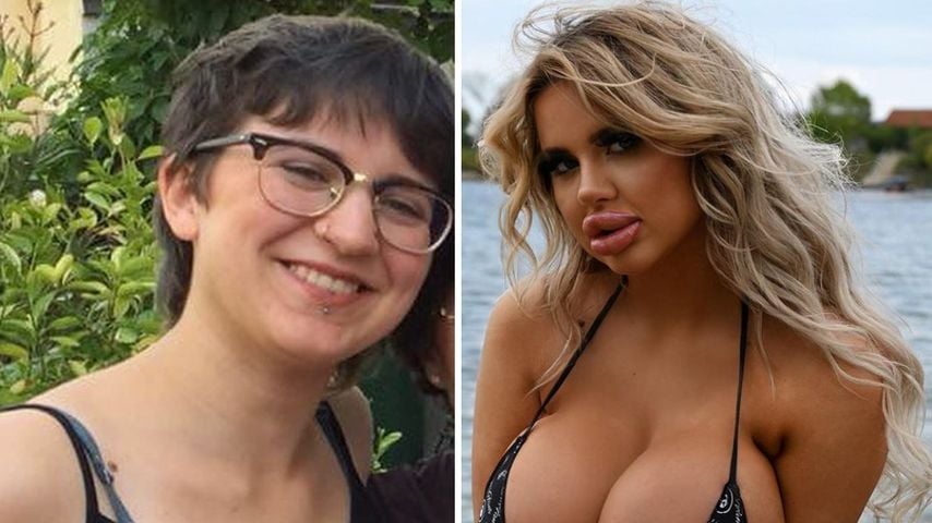 Erkannt? So sah Jessy Bunny vor ihren ganzen Beauty-OPs aus