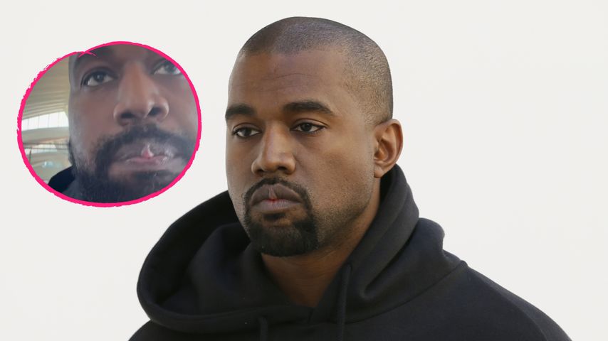 Wegen seiner Titanzähne: Fans sind in Sorge um Kanye West!