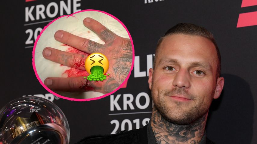 Blutige Wunde am Finger: Kontra K erklärt Videodreh-Unfall