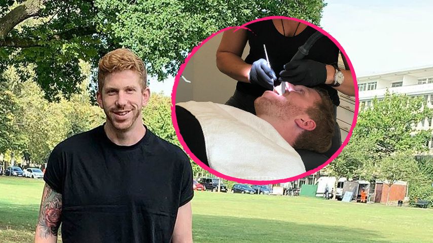 Behandlung: "Prince Charming"-Lars bekommt ein neues Lächeln