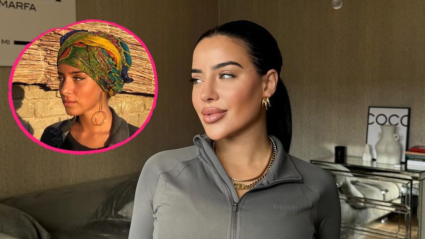 Krasse Veränderung! So sah Leyla Lahouar vor Injektionen aus