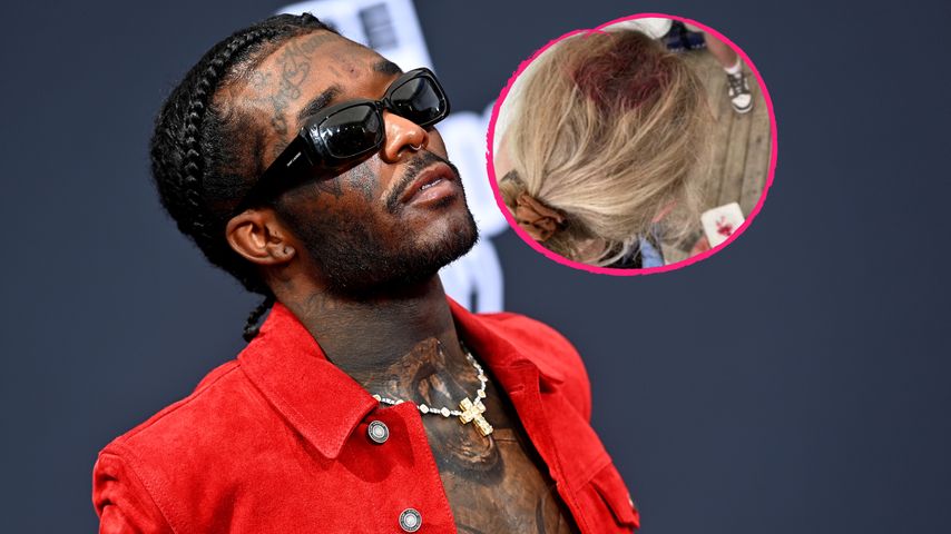 Lil Uzi Vert verletzte mit einem Handy einen Fan am Kopf!